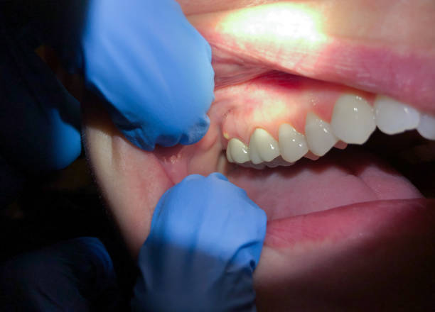 Best Emergency TMJ Treatment in Wayne City, IL